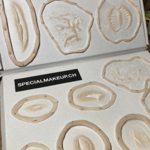 Wunden Prosthetics